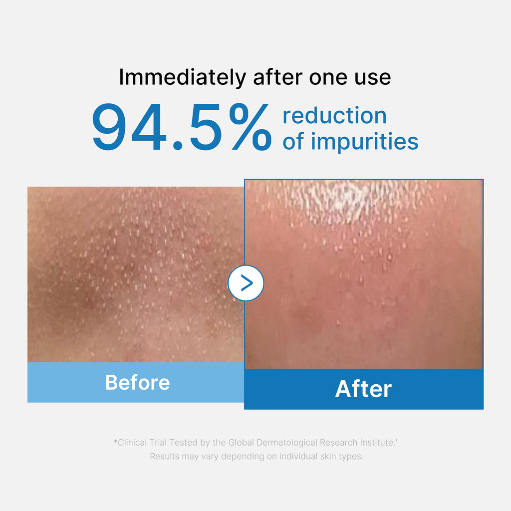 [GIFT] Zero Pore Blackhead Deep Cleansing Oil image 2
