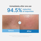 [Subscr.] Zero Pore Blackhead Deep Cleansing Oil image 2