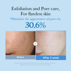 Zero Pore Toner image 2