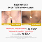 Kojic Acid Turmeric Body Peel Shot image 3