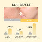 [Subscr.] Kojic Acid Turmeric Gold Jelly Gel Mask image 4