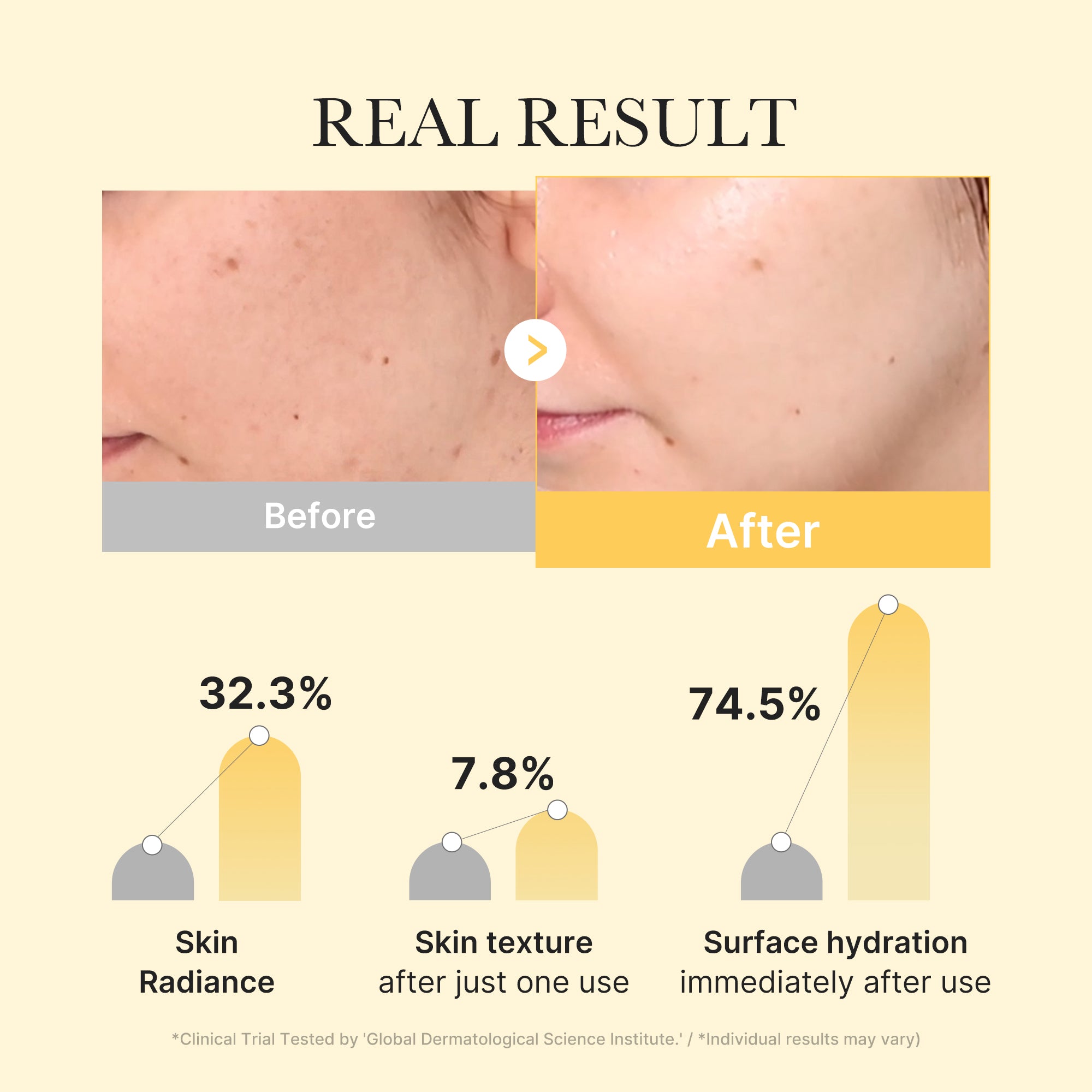Kojic Acid Turmeric Gold Jelly Gel Mask image 3
