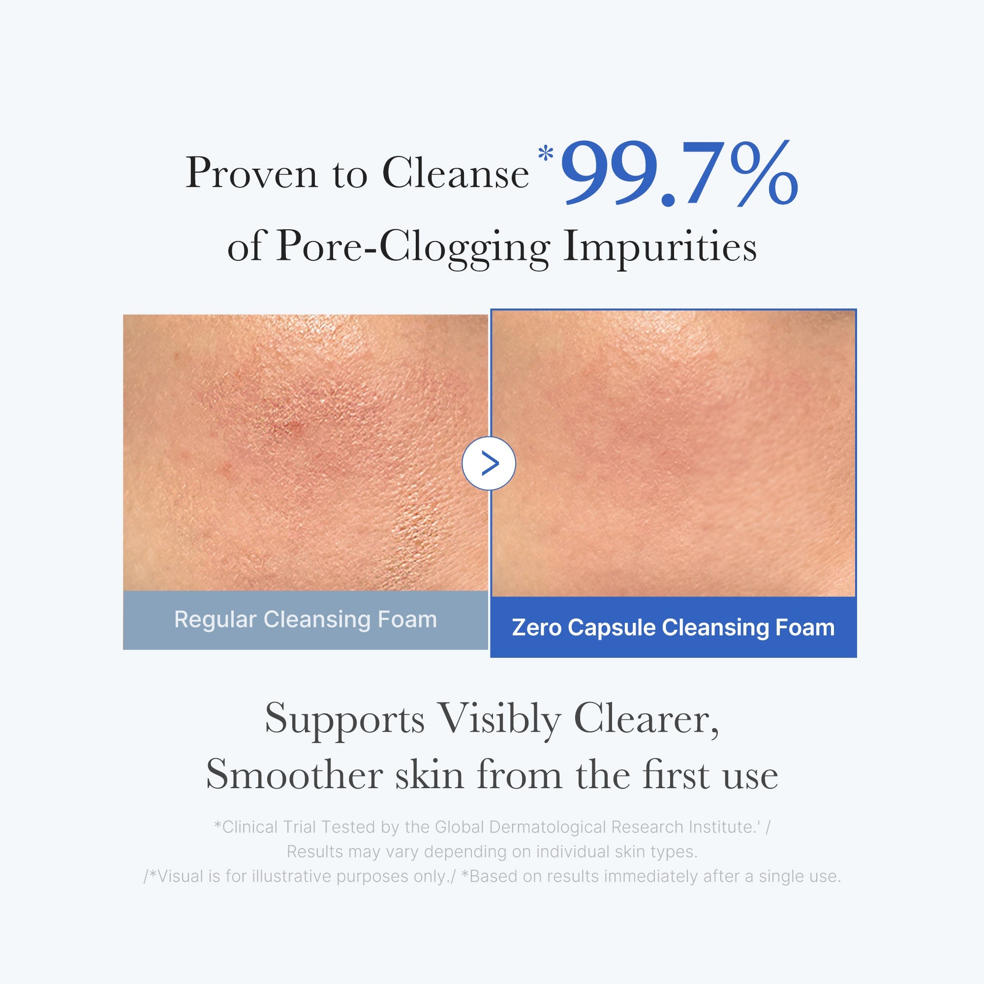 Zero Pore Capsule Cleansing Foam image 3