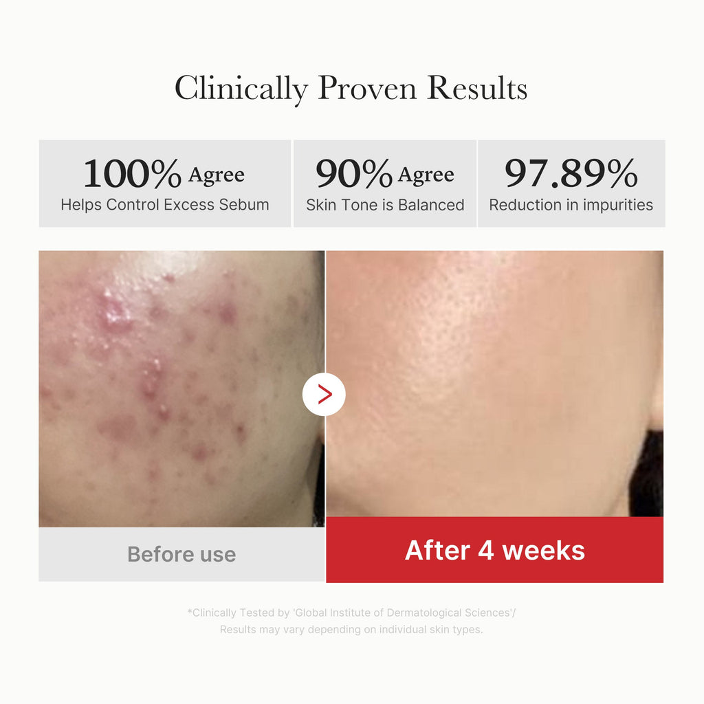 [Subscr.] Red Succinic Acid Panthenol Pads image 4