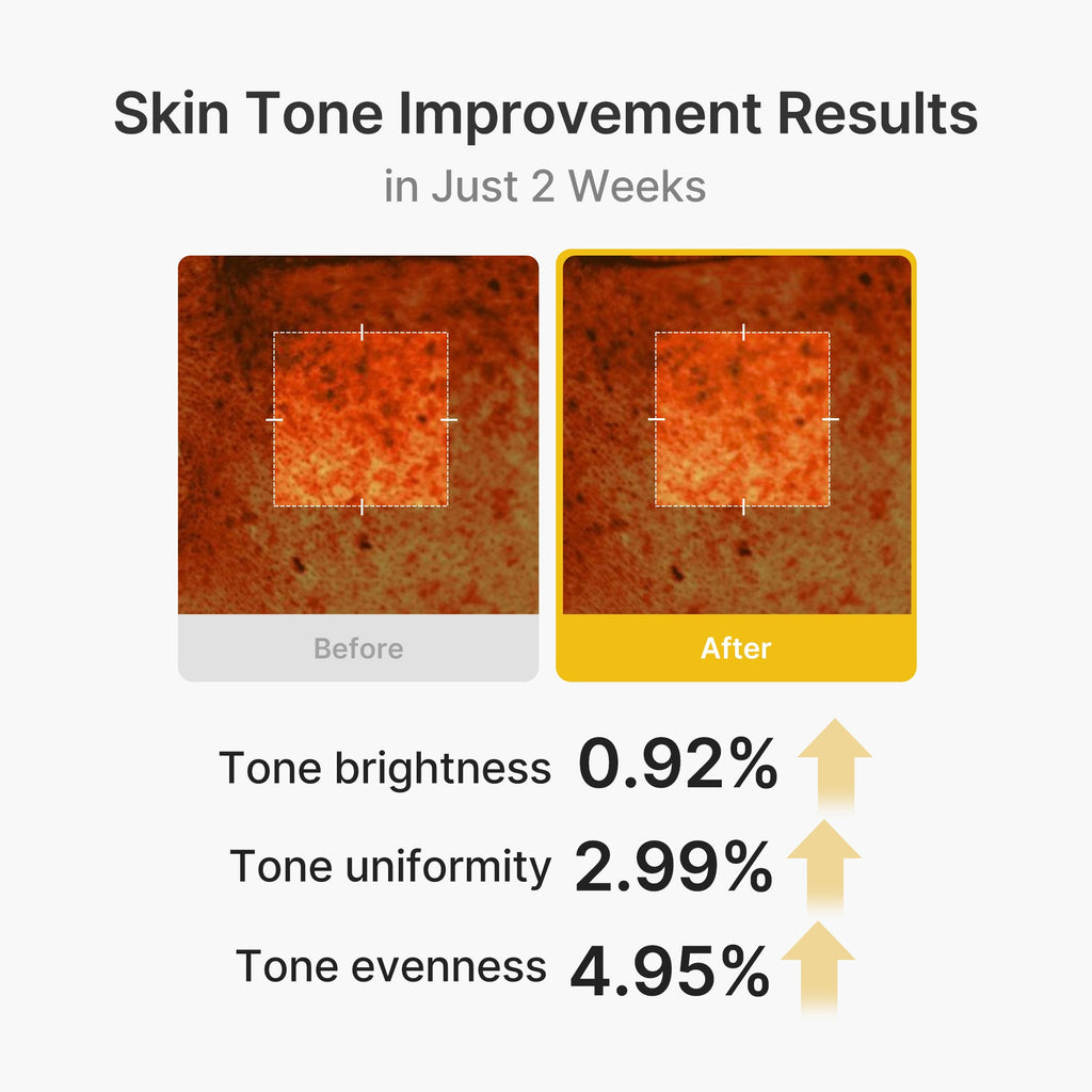 Kojic Acid Turmeric Vita Capsule Cream image 4