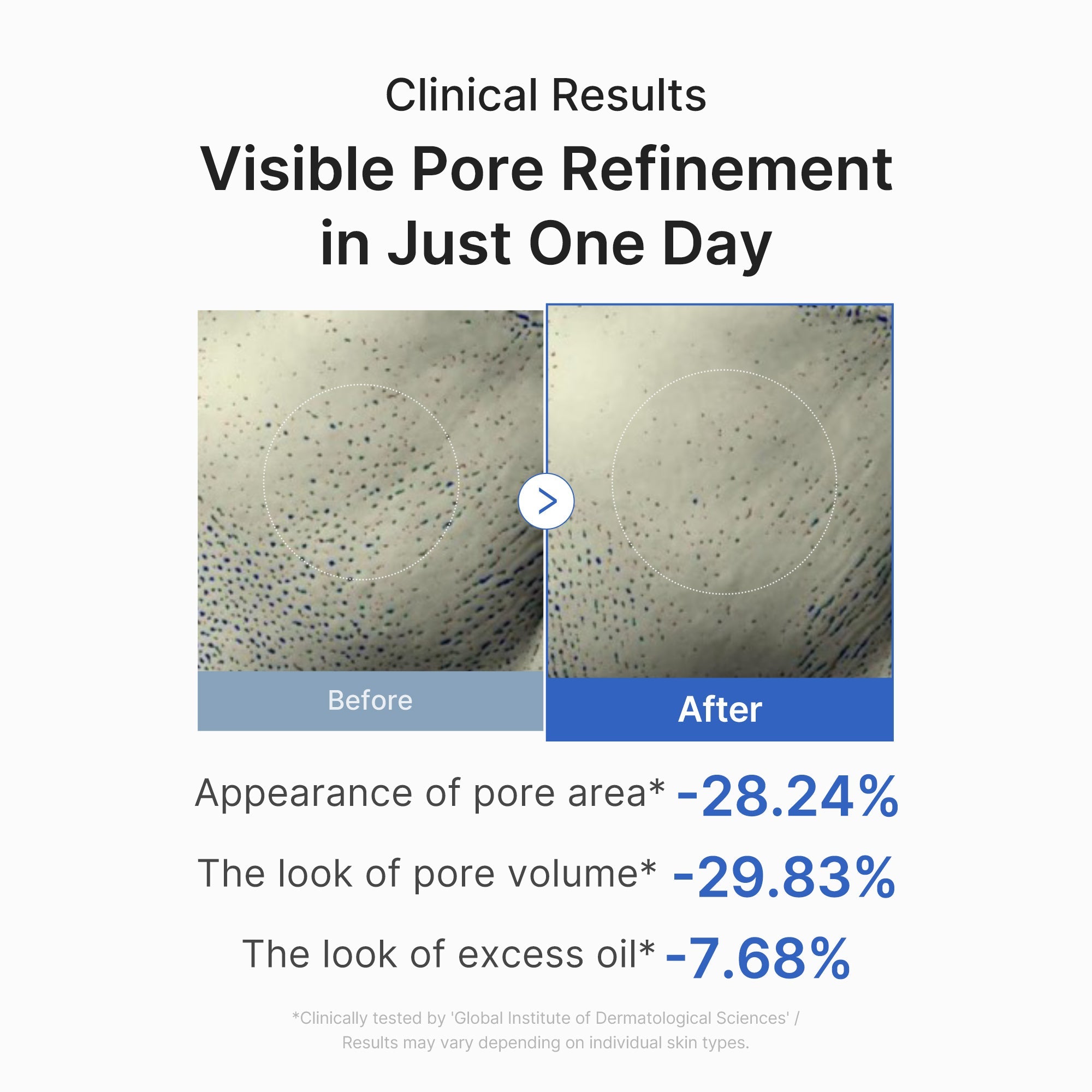 Zero Pore One-day Peptide Serum image 6