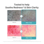 Azelaic Acid Capsule Foam Cleanser image 4