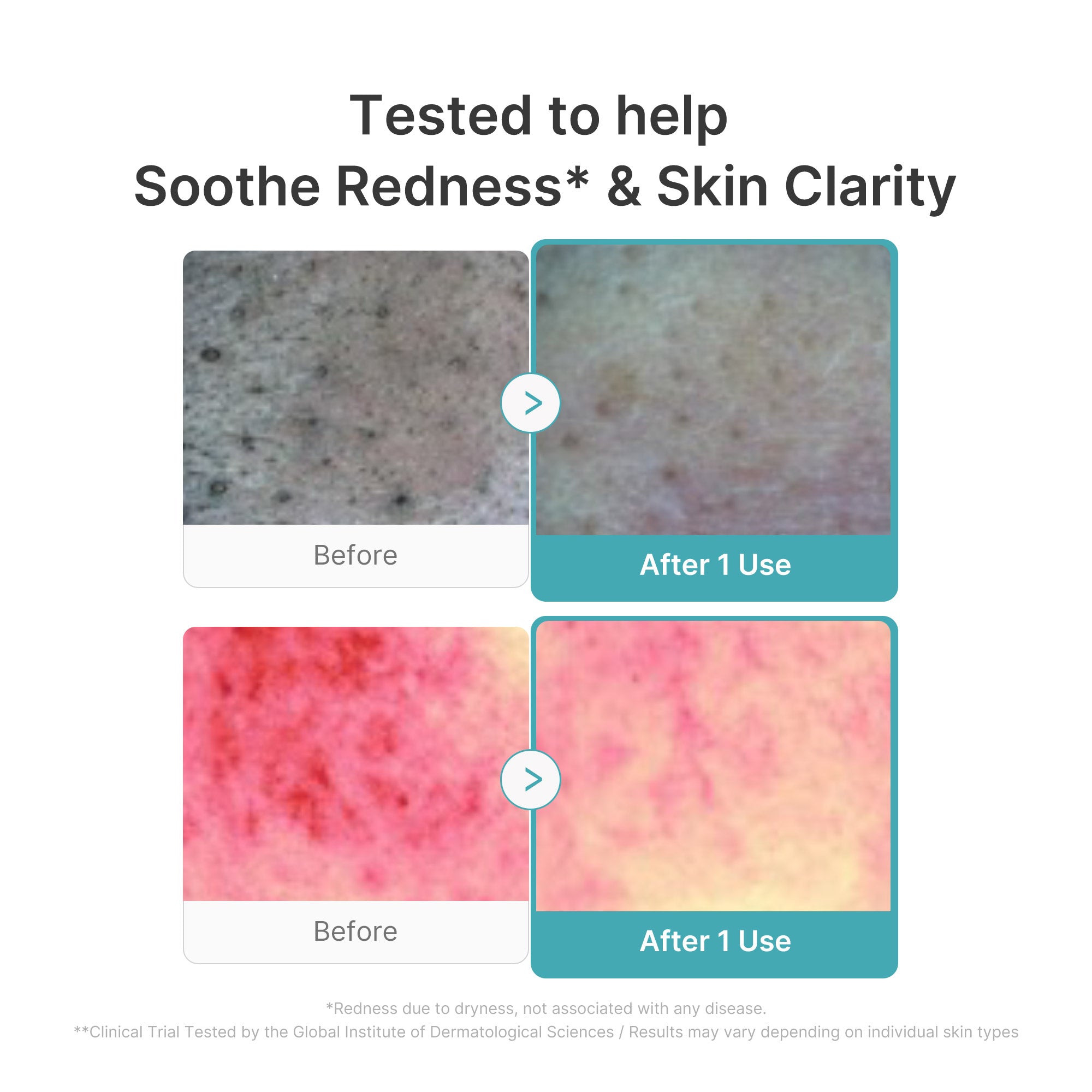 Azelaic Acid Capsule Foam Cleanser image 4