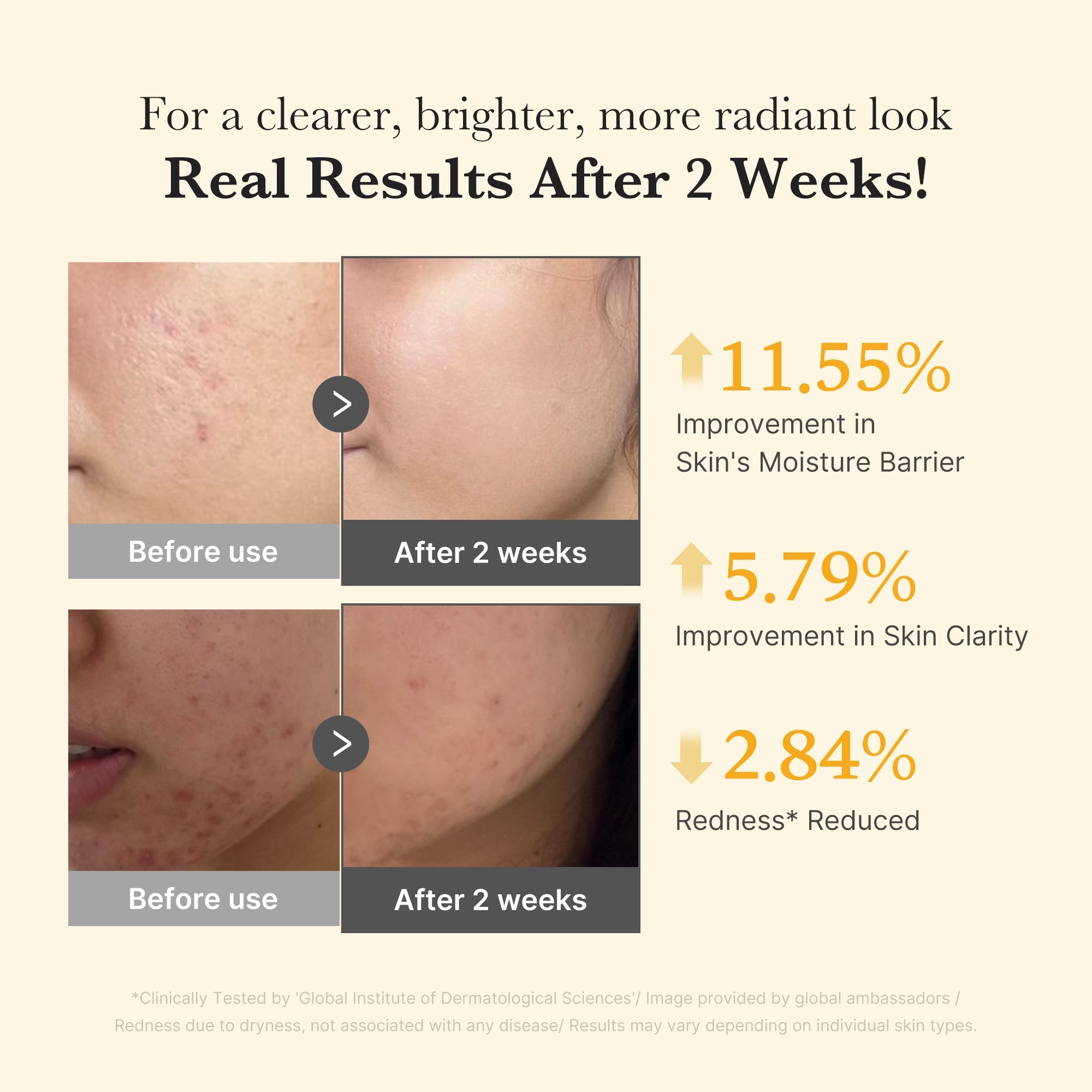 [GIFT] Kojic Acid Turmeric Capsule Serum image 4