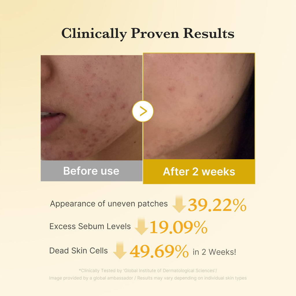 [Subscr.] Kojic Acid Tumeric Toner Pad image 4