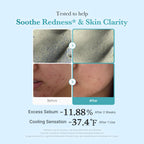 Azelaic Acid Niacinamide Clarifying Toner image 4