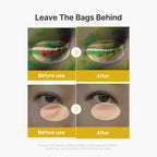 Kojic Acid Tumeric Eye Gel Serum image 5