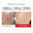 [GIFT] Red Succinic Acid Panthenol Pads image 4