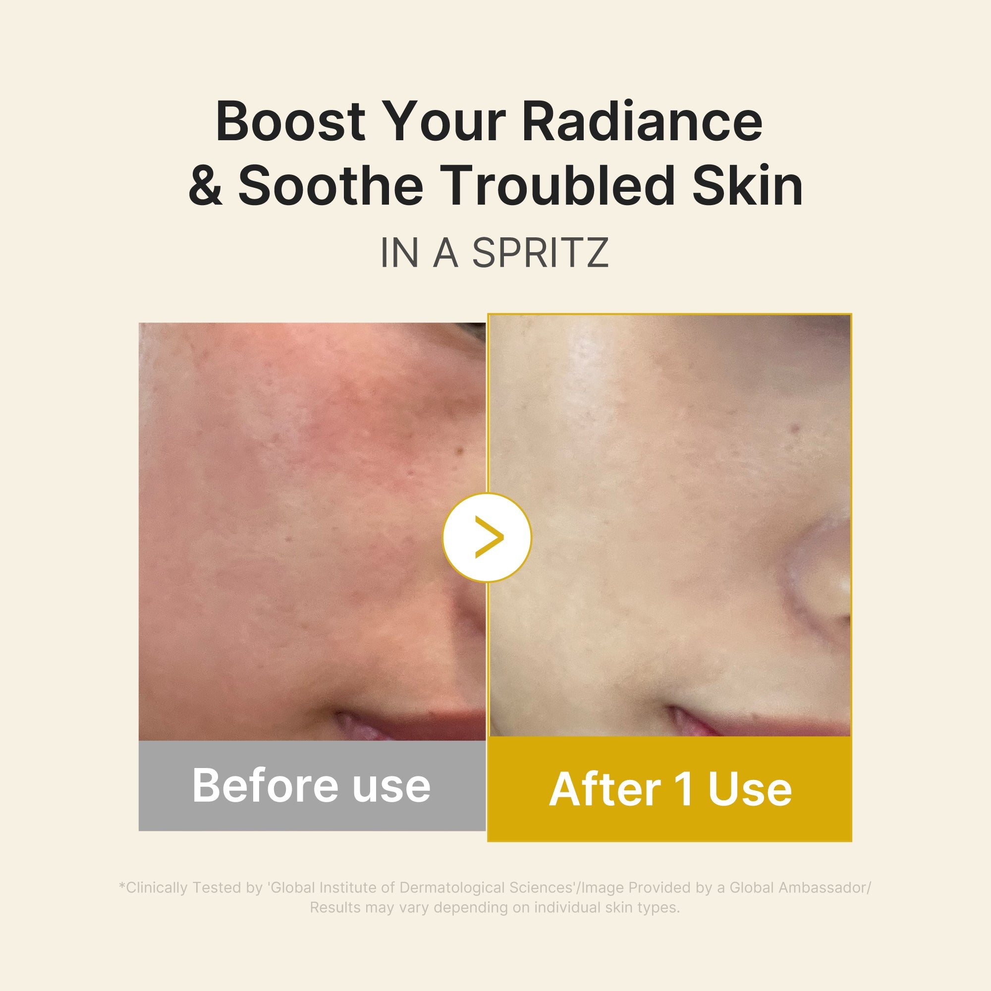 Kojic Acid Turmeric Vitamin Gold Jelly Mist Serum image 4