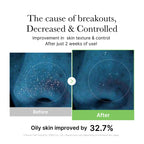 [GIFT] Exosome Cica Calming Toner image 4