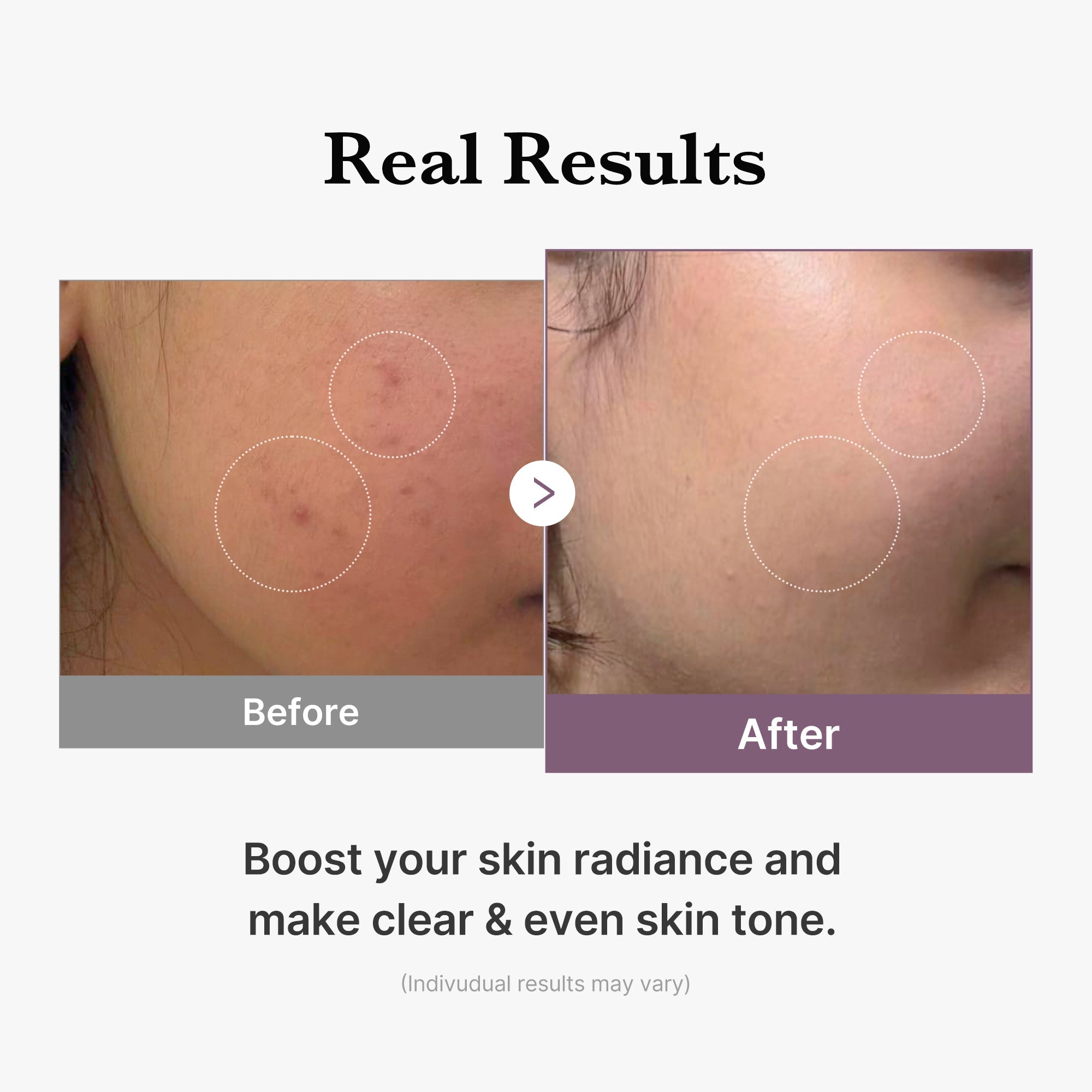 AGE-R Glutathione Glow Milk Toner image 5