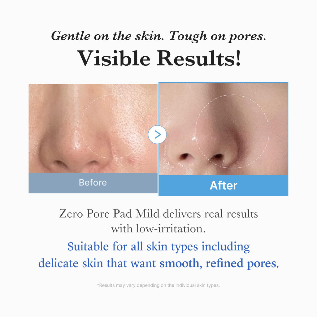 Zero Pore Madecassoside Pads (Mild) image 5
