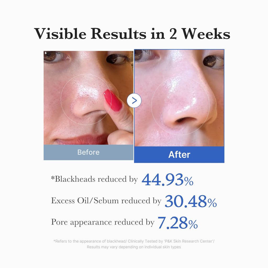 Zero Pore Pads image 5