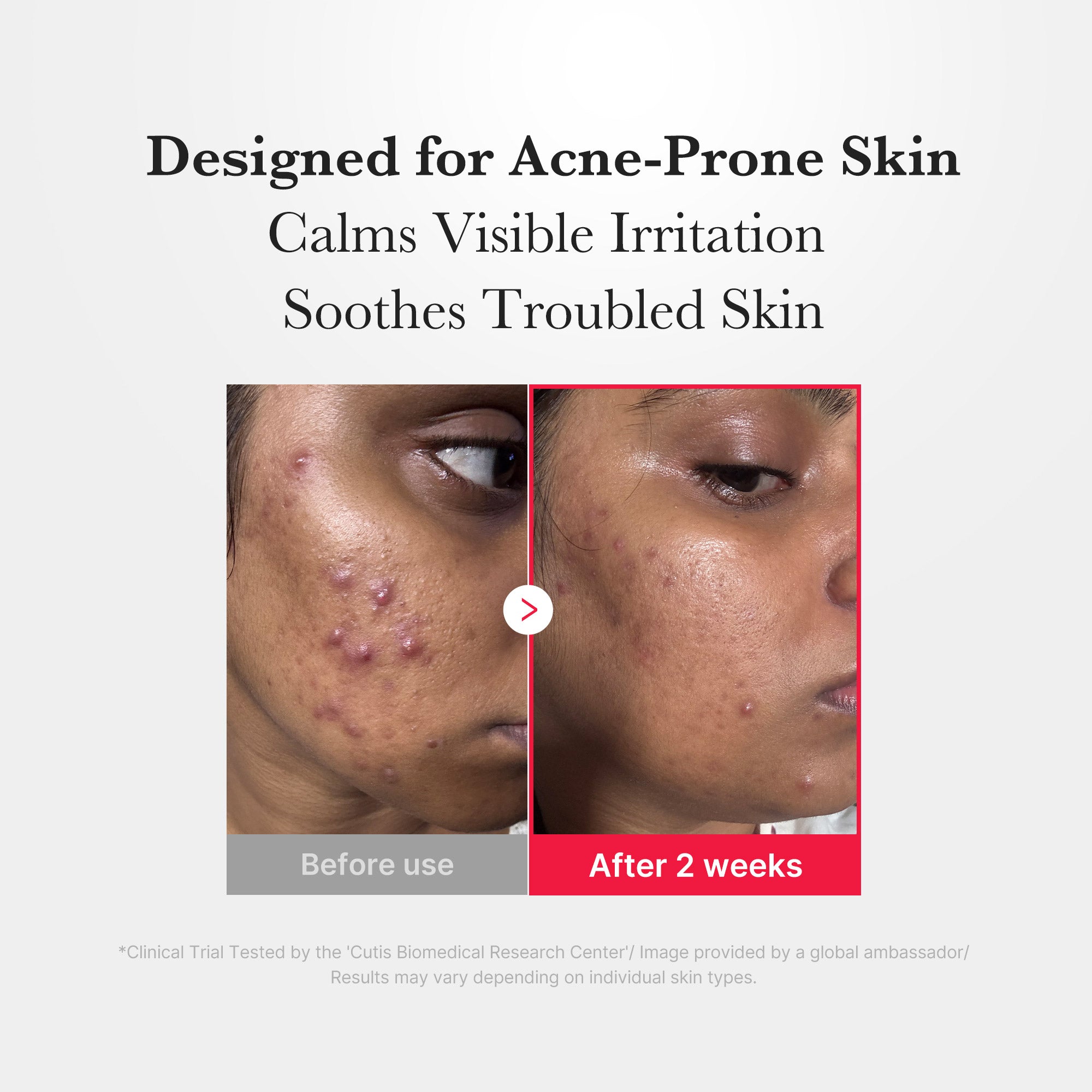 [Subscr.] Hypochlorous Acid Power Soothing Spray image 5