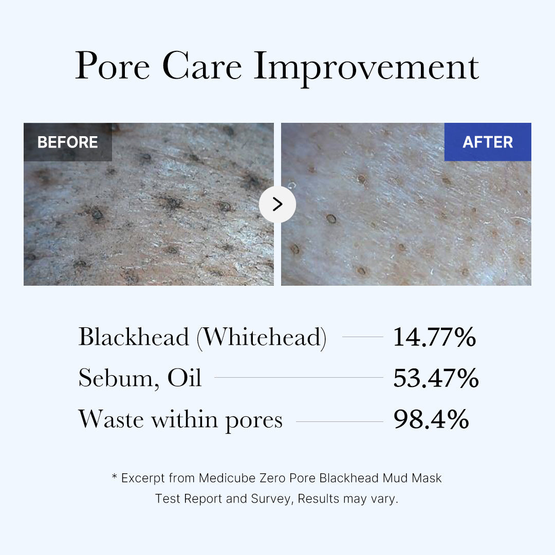 [Subscr.] Zero Pore Blackhead Mud Mask image 5
