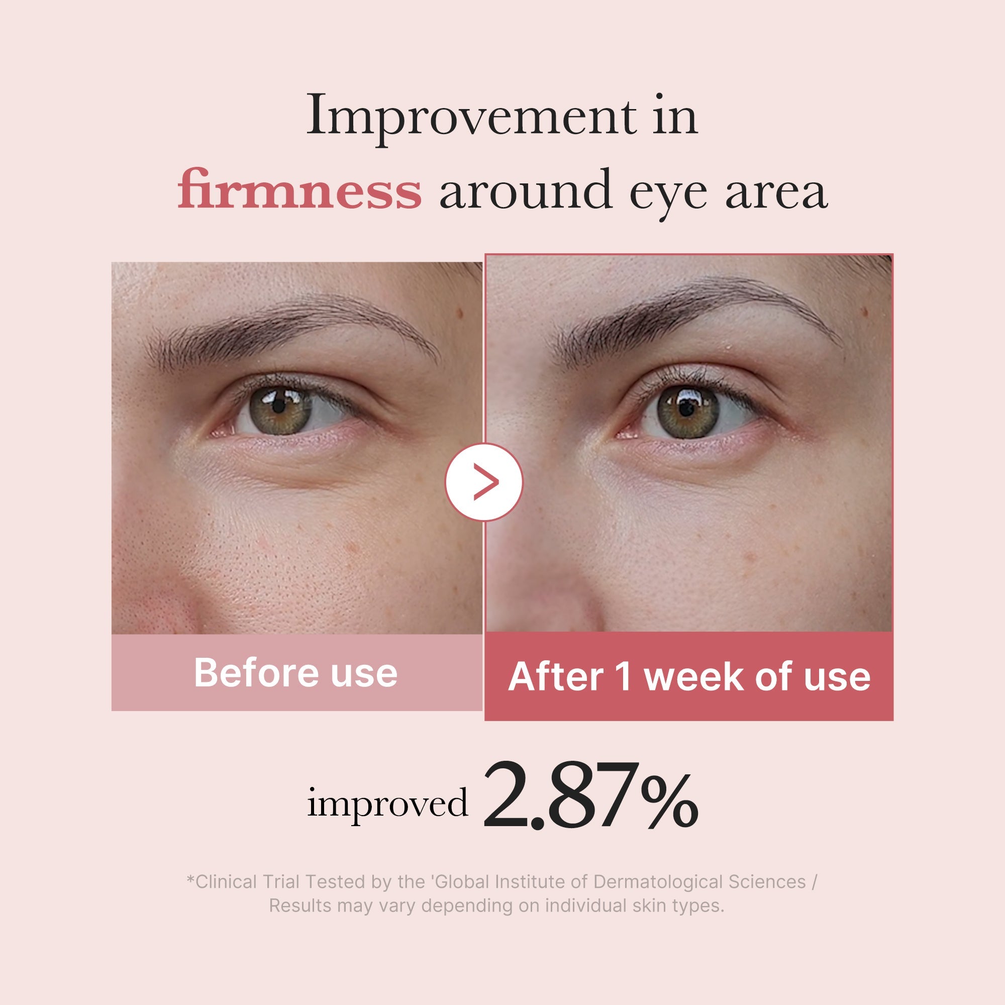 PDRN Pink Peptide Eye Cream image 4