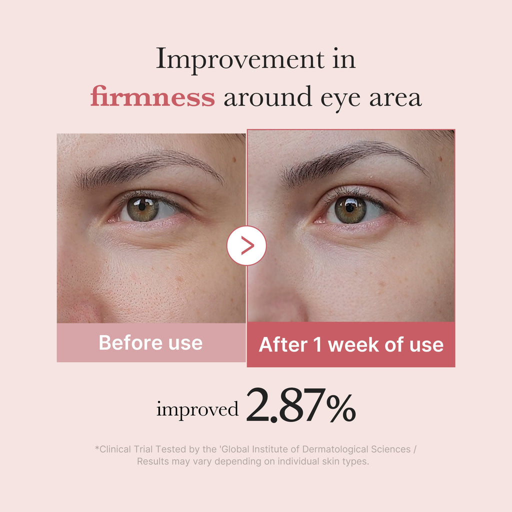 [Subscr.] PDRN Pink Peptide Eye Cream image 4