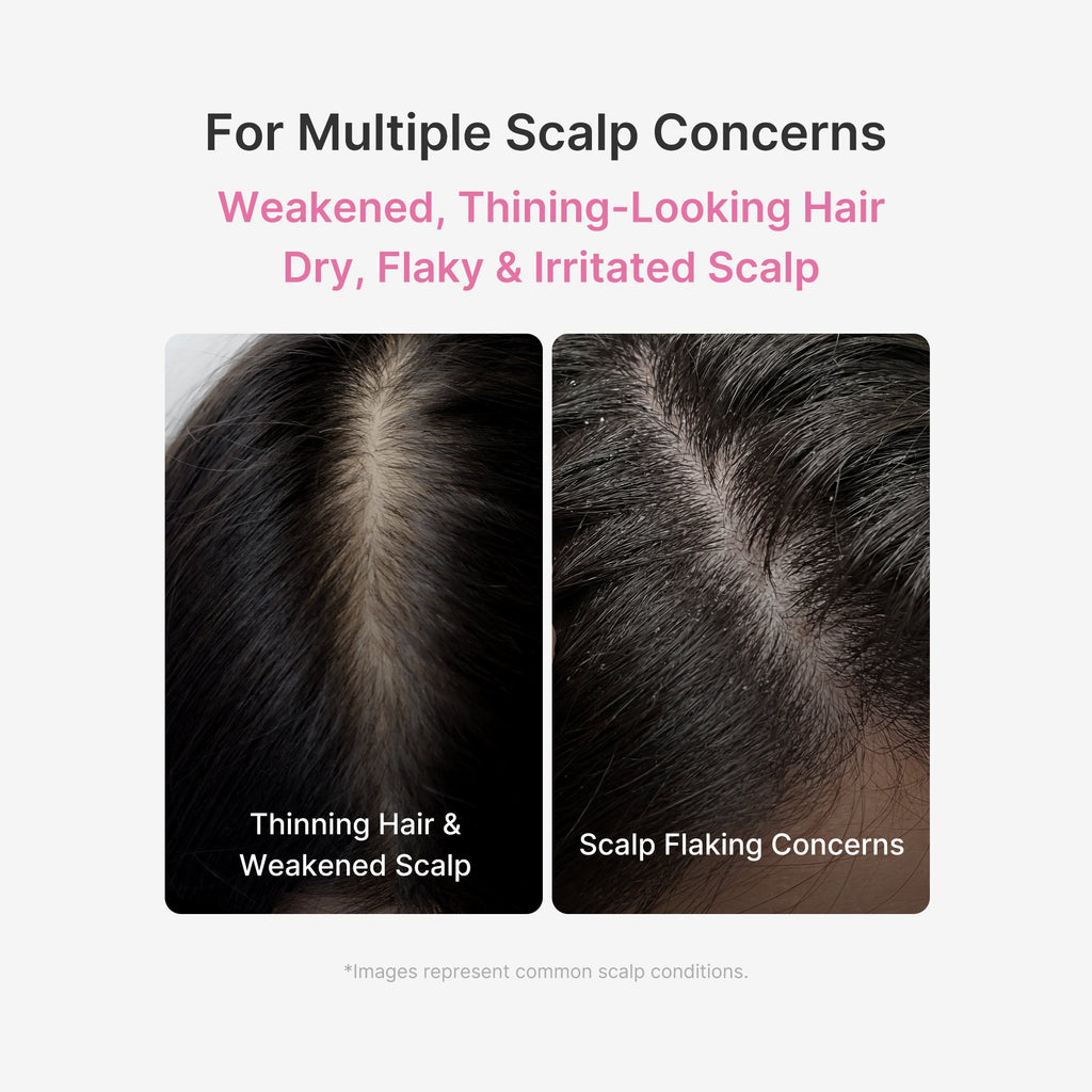 Rosemary PDRN Scalp Serum image 3