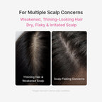 Rosemary PDRN Scalp Serum image 3