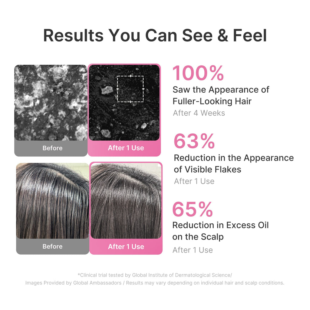 Rosemary PDRN Cooling Thickening Shampoo image 5