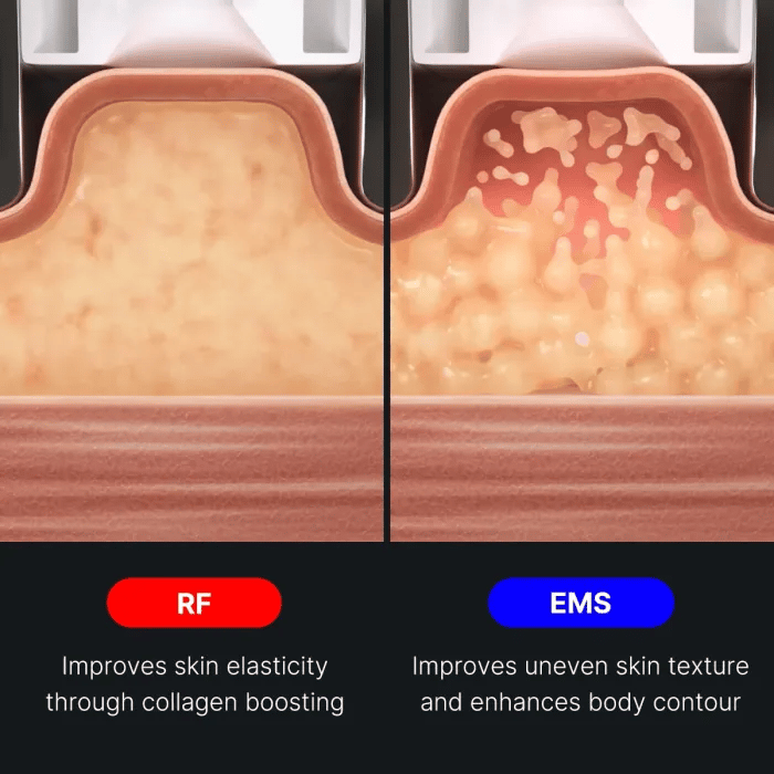 AGE-R Contour Body Shot image 5